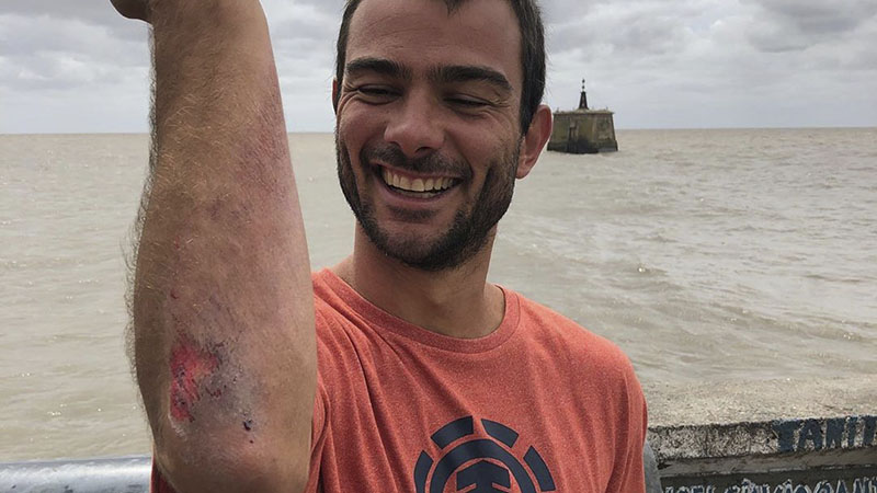 Seba Franco y una fuerte caída con su skate